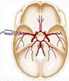 Ultrazvok možganskih žil -TCD 6, ilustarcija
